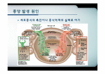종양면역과 영양-4