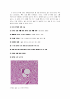 [자원과 환경] 광우병-5