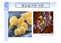 [식품위생학] 식중독에 대하여-16