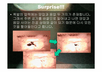 폭탄 & 혈흔 레포트-5