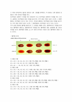 [대학생물학] 혈액의 응고 반응 관찰 실험-3