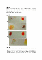 [대학생물학] 혈액의 응고 반응 관찰 실험-4