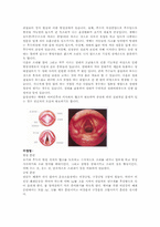 [재활학개론] 재활치료의 종류와 치료목적(언어치료 중심)-8