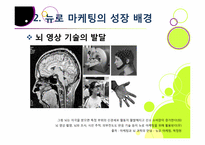 뉴로 마케팅의 정의와 특징 및 장단점 이해, 뉴로 마케팅 활용 분야 및 대표 사례 분석, 뉴로마케팅의 향후 전망 및 발전 방향-11
