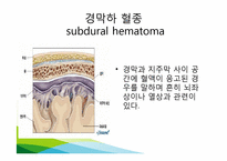 [간호학] SDH 레포트-17