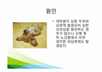 [간호학] SDH 레포트-19