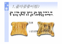 [스포츠와건강관리] 골다공증과 운동처방-3
