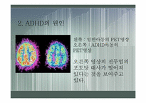 정신분열증의 원인과 ADHD의 원인에 대한 최신지견 조사-15