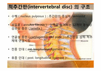[물리치료학] 경추HNP(Herniated Nucleus Pulposus) 분석-3