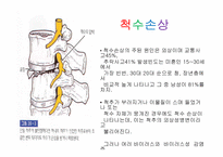 척수손상 PPT 레포트-5