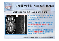 성체줄기세포(adult stem cell)-13