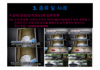 성도착증 레포트-6