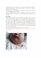 [임상영양학 사례연구] 아토피 사례-8