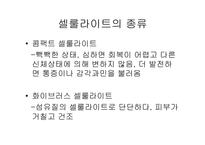 셀룰라이트의 종류와 특성및 제품-3