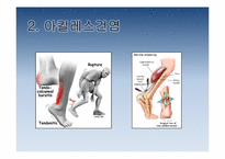 [보건교육] 하이힐이 발건강에 미치는 영향-8
