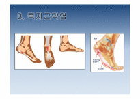 [보건교육] 하이힐이 발건강에 미치는 영향-9