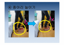 [보건교육] 하이힐이 발건강에 미치는 영향-20