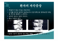 [생화학] 퇴행성 디스크에 관한 분석-9