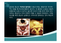 [생화학] 퇴행성 디스크에 관한 분석-10