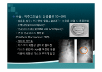 [생화학] 퇴행성 디스크에 관한 분석-13