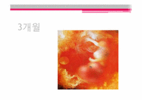 태아기 레포트-14