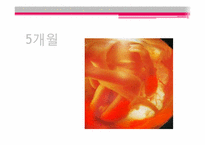 태아기 레포트-16