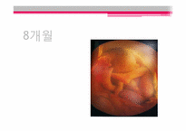 태아기 레포트-19