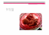태아기 레포트-20