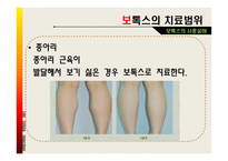 [약과건강] 보톡스에 관한 분석-11