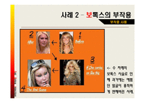 [약과건강] 보톡스에 관한 분석-17