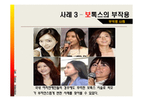 [약과건강] 보톡스에 관한 분석-18