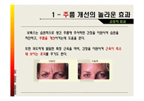 [약과건강] 보톡스에 관한 분석-20