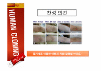 [기술과사회] 인간 복제 연구에 관한 고찰(반대의 입장)-15