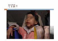 [인권과사회]아동학대실태 진단과 아동인권발전방안-2