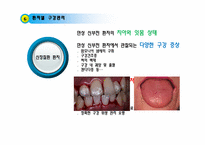 [기본간호학] 개인위생 -구강간호수행-13