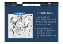 [체동학] 운동선수 직업병 속의 체동학-11