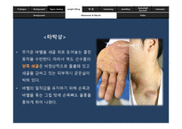[체동학] 운동선수 직업병 속의 체동학-16