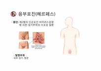 [성의생물학] Venereal Disease(성병)에 관한 분석-17