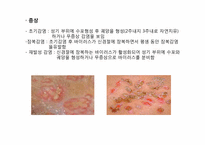 [성의생물학] Venereal Disease(성병)에 관한 분석-18