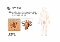 [성의생물학] Venereal Disease(성병)에 관한 분석-19
