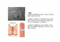 [성의생물학] Venereal Disease(성병)에 관한 분석-20