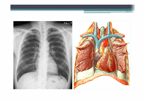 [PBL] Chest X-ray(흉부X-레이)-9