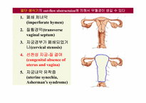 무월경(Amenorrhea)에 대하여-7
