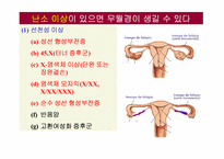 무월경(Amenorrhea)에 대하여-10