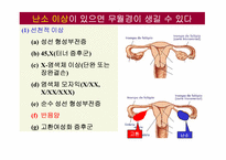 무월경(Amenorrhea)에 대하여-11