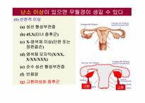 무월경(Amenorrhea)에 대하여-12