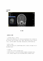 [한의학] 현훈을 호소하는 환자 사례-2