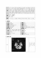 [한의학][소아과사례] 옴(Scabies)에 감염된 Cb-inf. 환자-2