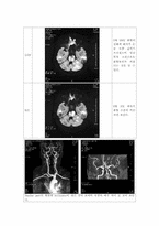 [한의학][소아과사례] 옴(Scabies)에 감염된 Cb-inf. 환자-3