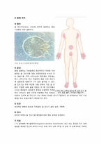 [한의학][소아과사례] 옴(Scabies)에 감염된 Cb-inf. 환자-5